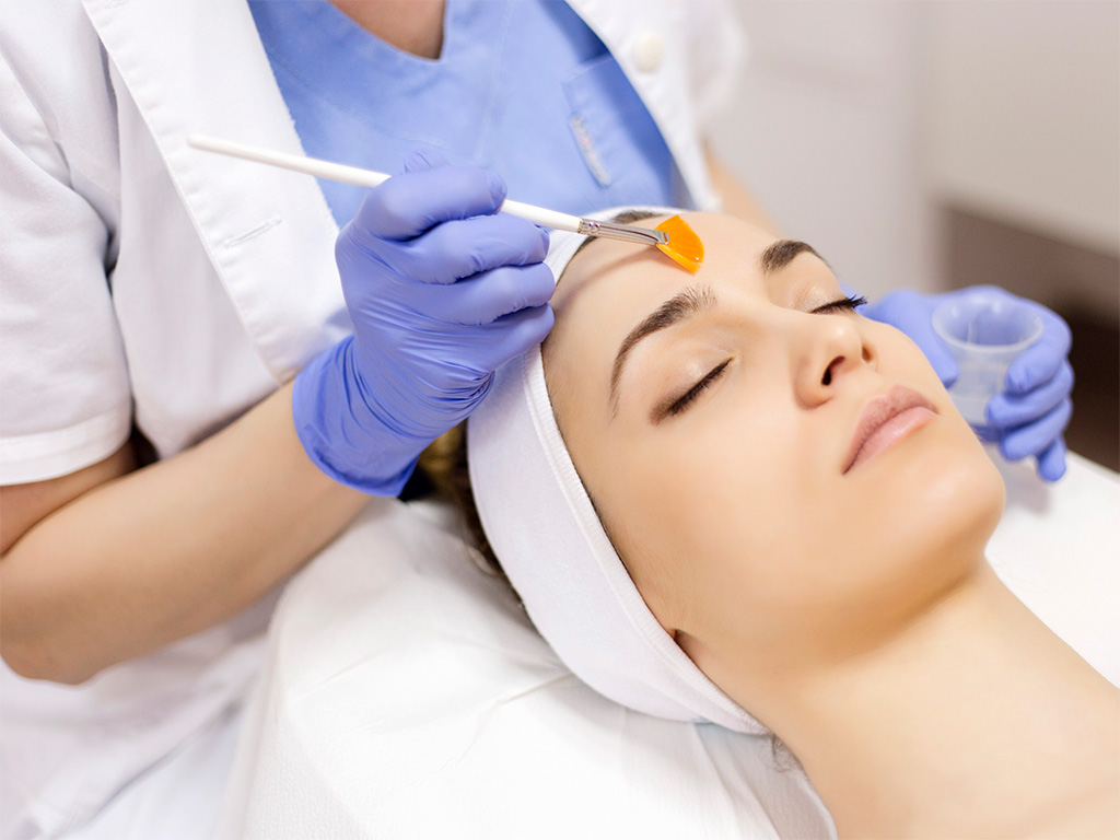carta peeling en murcia