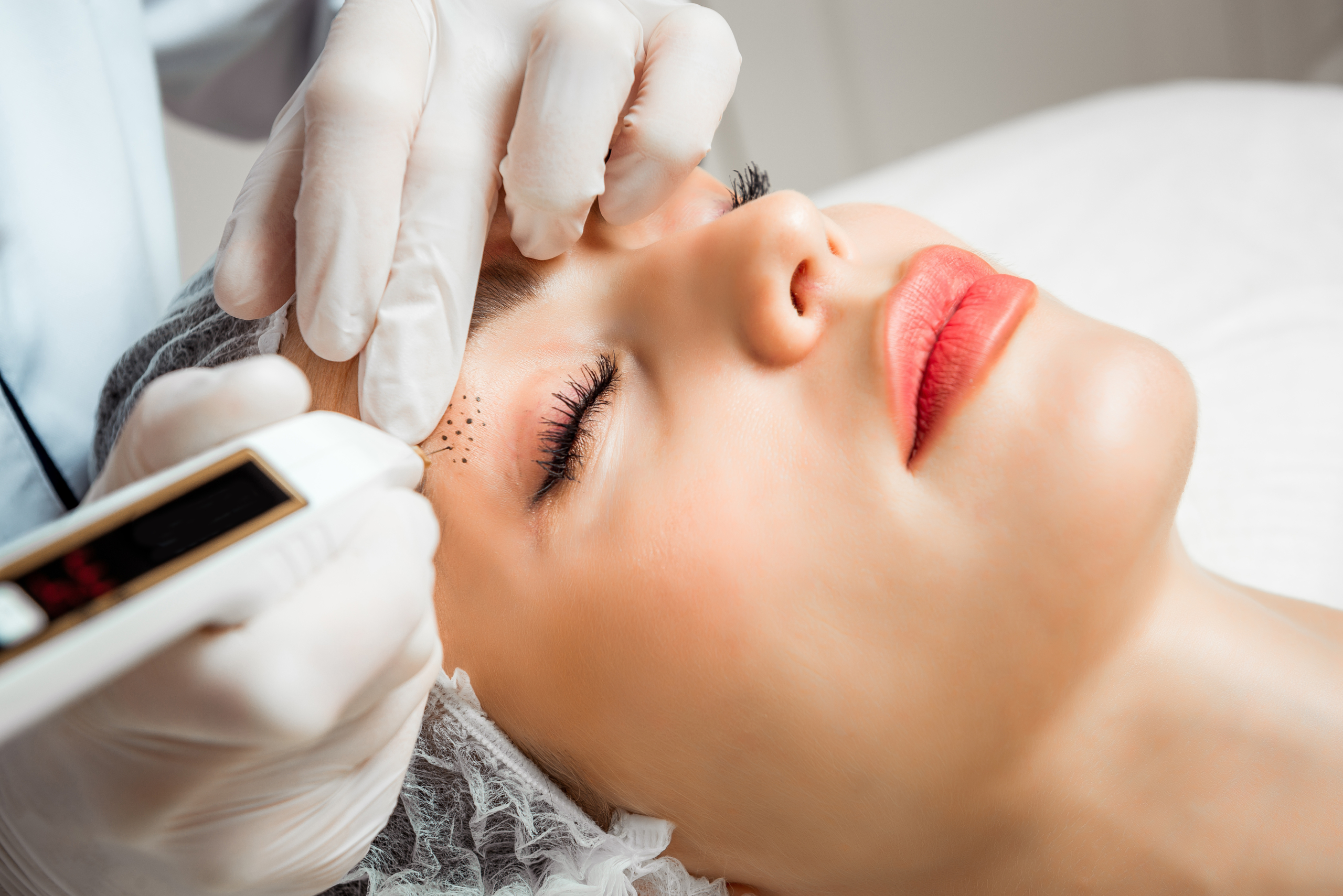 mejor tratamiento facial murcia